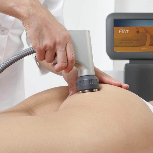 shockwavetherapy03
